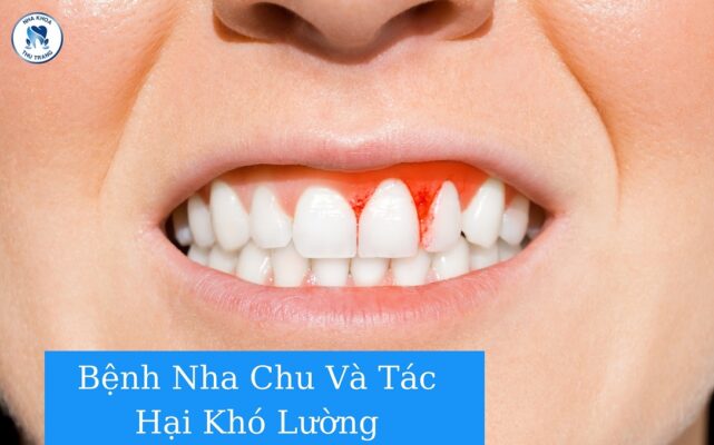 Bệnh nha chu và tác hại khó lường