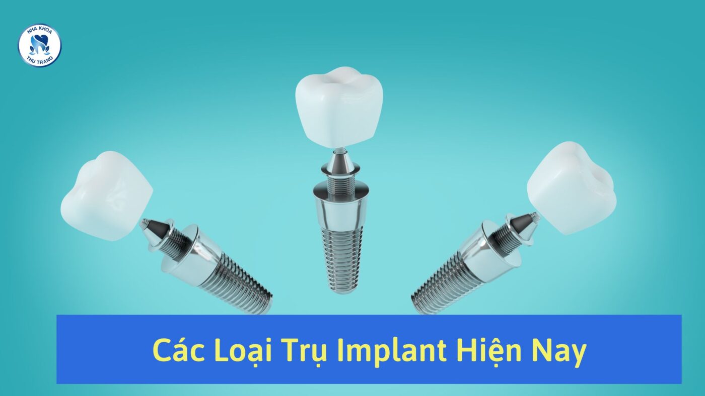 Các loại trụ Implant hiện nay