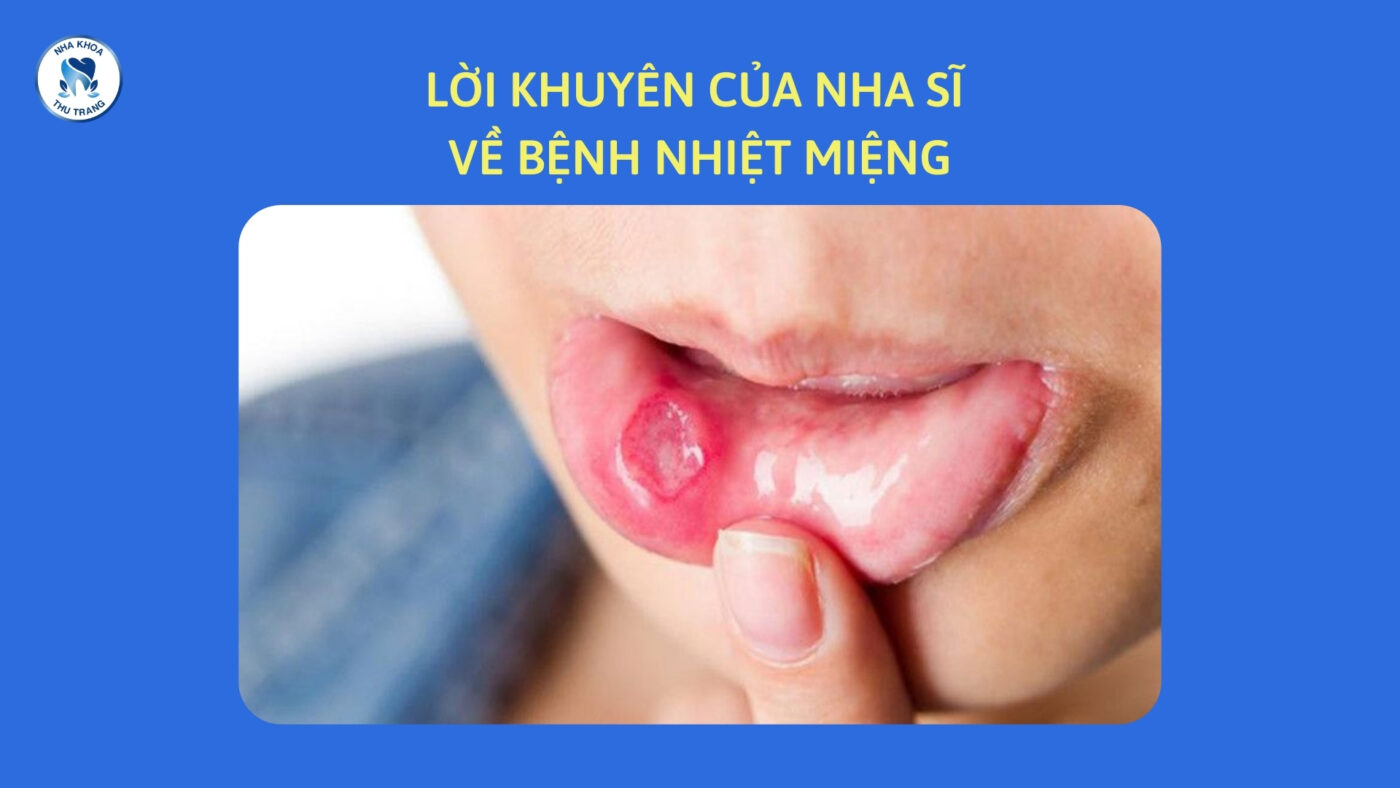 Lời khuyên của nha sĩ về bệnh nhiệt miệng