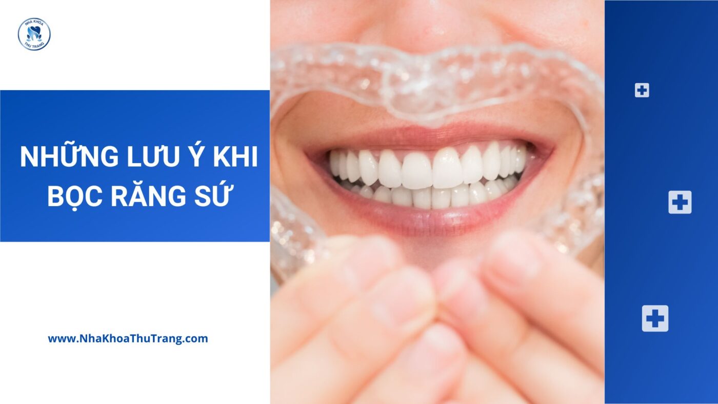 Những Lưu Ý Khi Bọc Răng Sứ Thẩm Mỹ