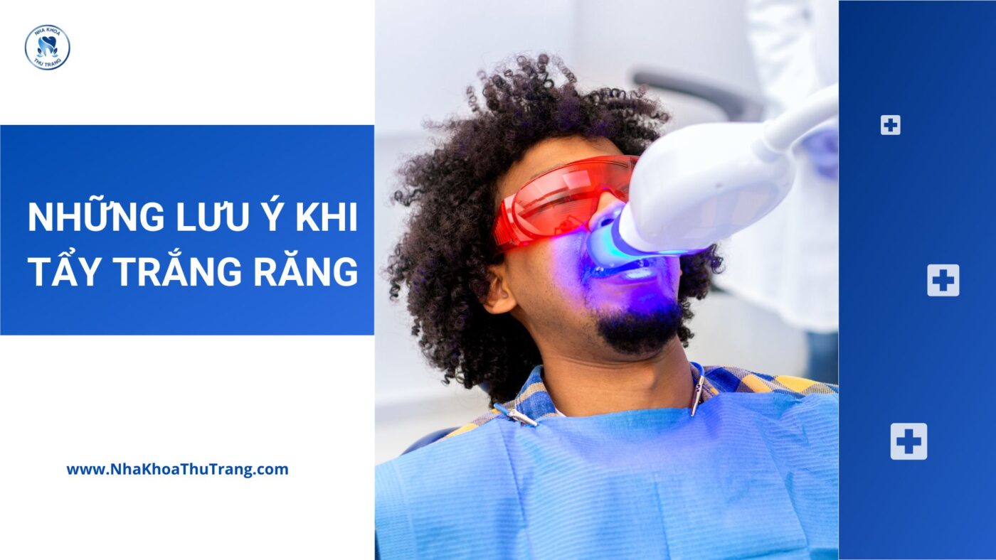 Những lưu ý khi thực hiện tẩy trắng răng