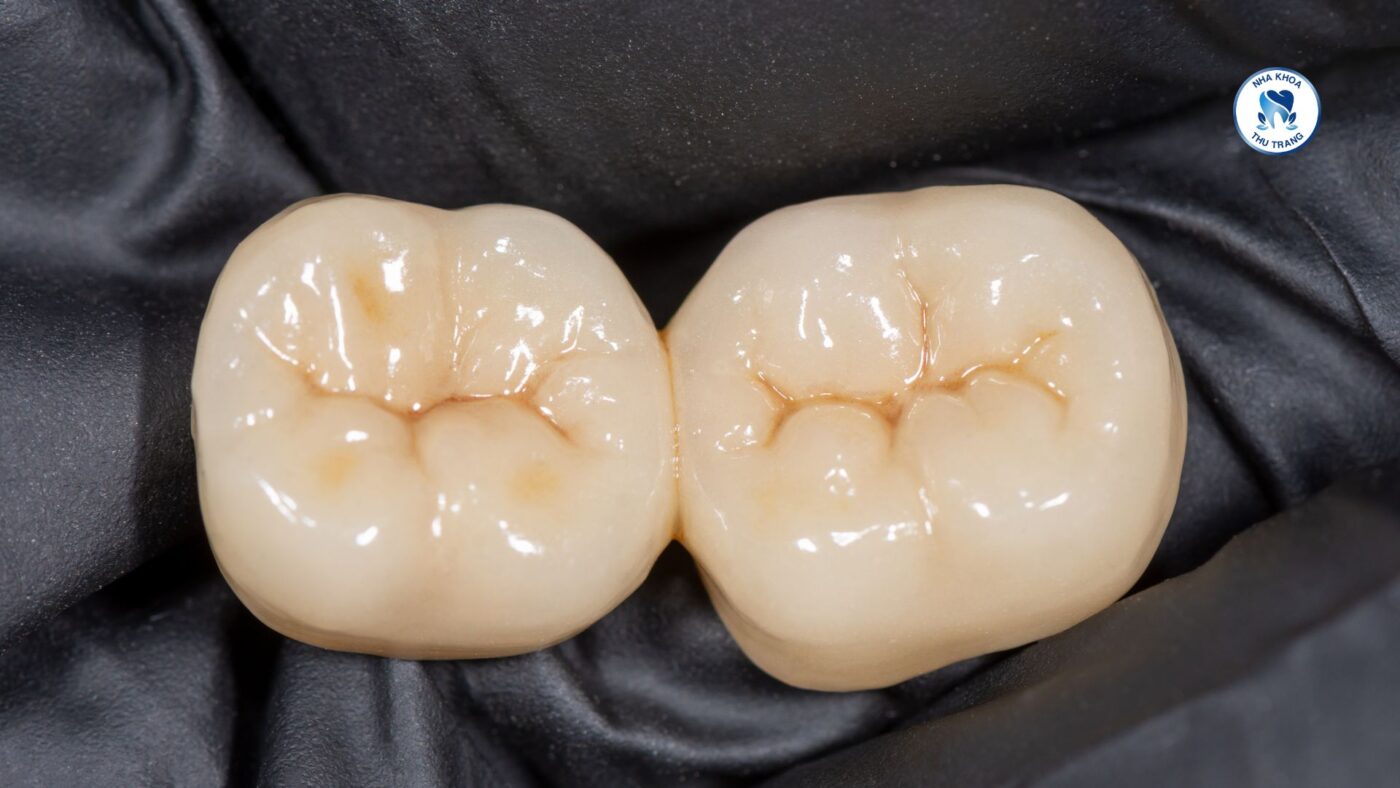 Khi nào nên bọc răng sứa