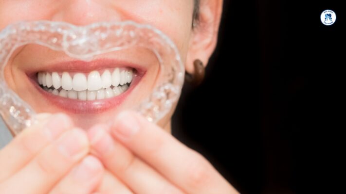 Răng sứ thẩm mỹ