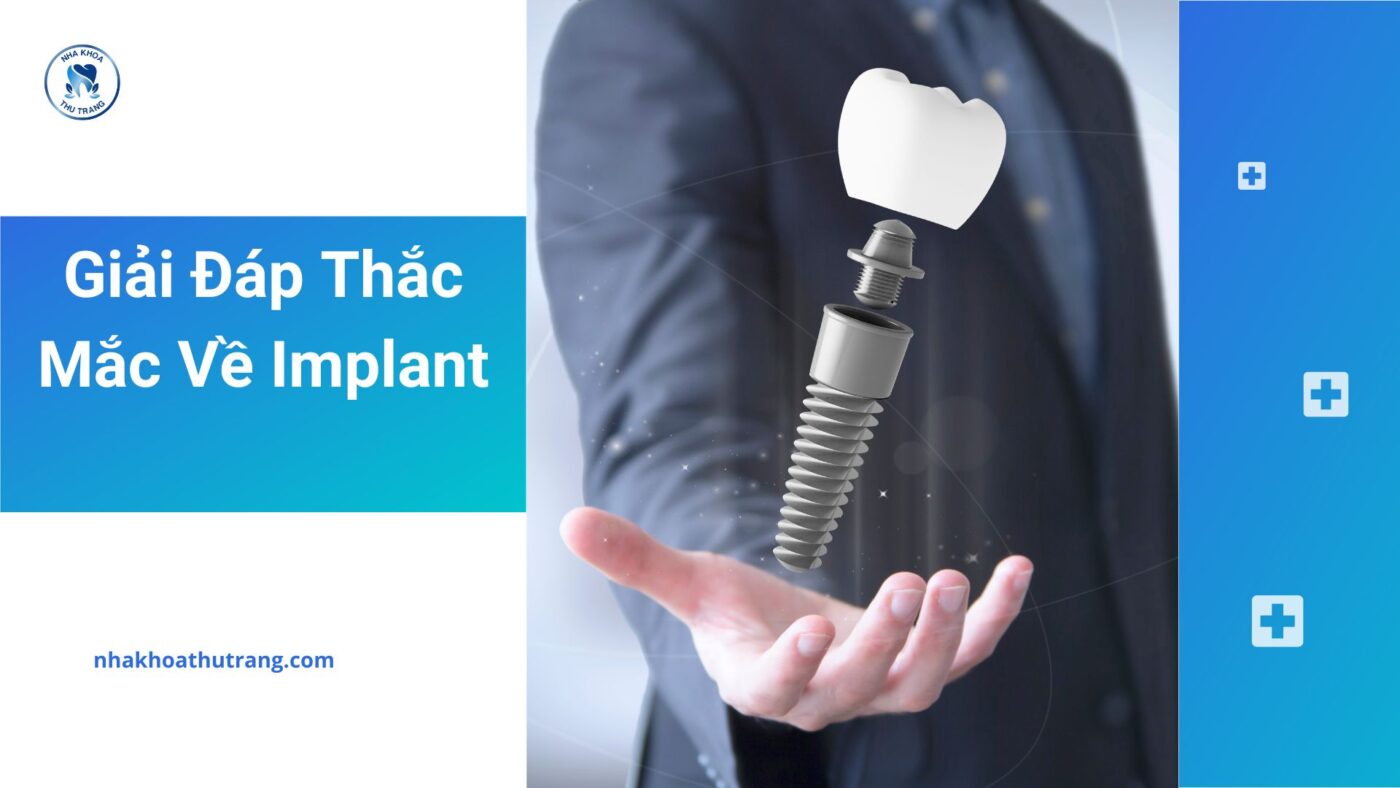 Giải đáp thắc mắc về Implant trong nha khoa