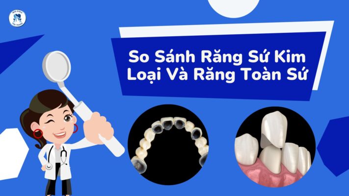 So sánh răng sứ kim loại và răng toàn sứ