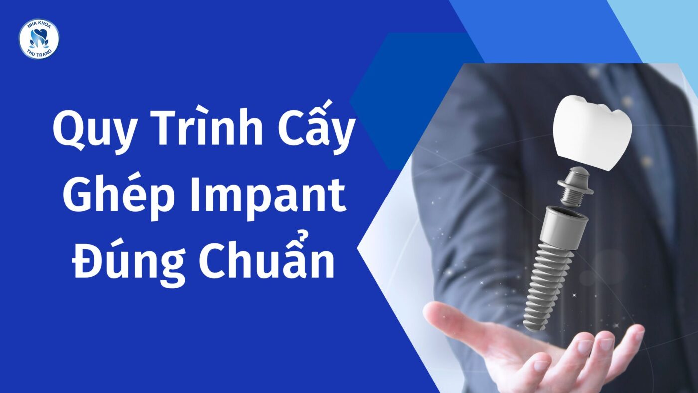 Quy trình cấy ghép implant đúing chuẩn