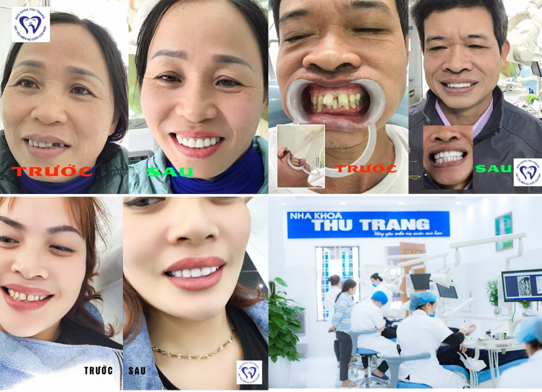 Đâu là địa chỉ phòng khám răng hàm mặt tốt ,uy tín, chất lượng cao nhất tại Chương Mỹ