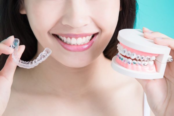 đeo hàm duy trì sau tháo niềng răng