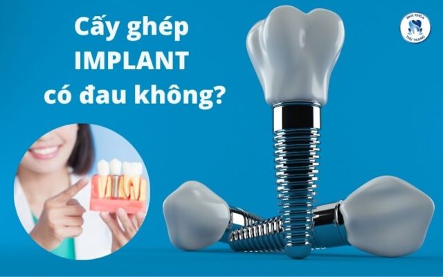 Cấy ghép implant có đau không