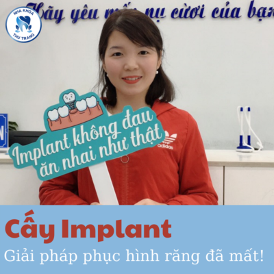 Những lưu ý khi cấy ghép răng implant