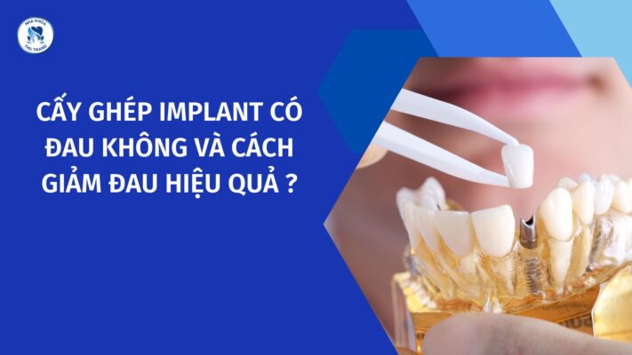Cấy ghép implant có đau không và cách giảm đau hiệu quả khi cấy