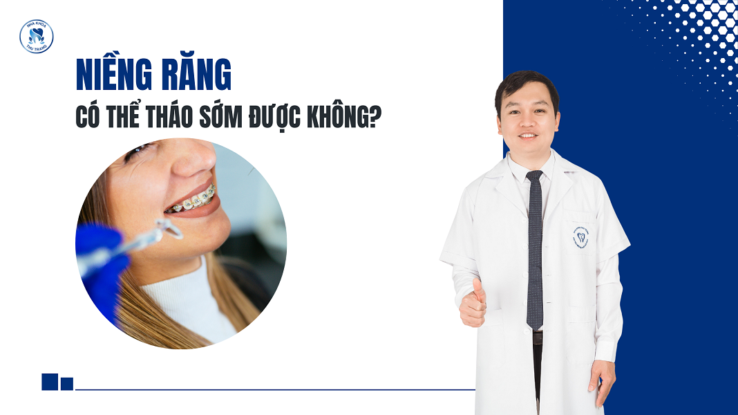 Có nên tháo niềng răng sớm không