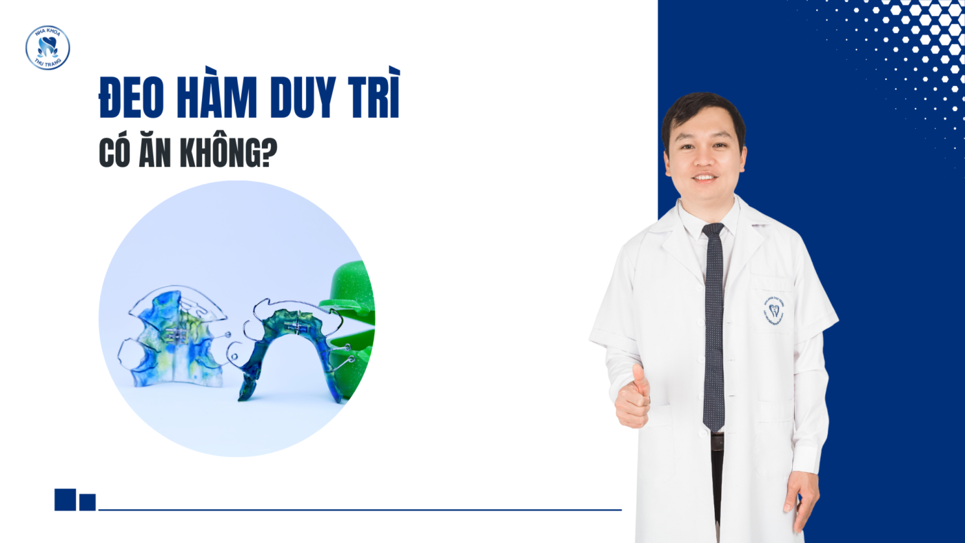 Tại sao phải đeo hàm duy trì khi niềng răng?