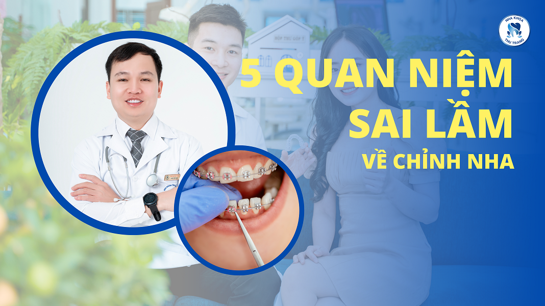 5 quan niệm sai lầm về chỉnh nha