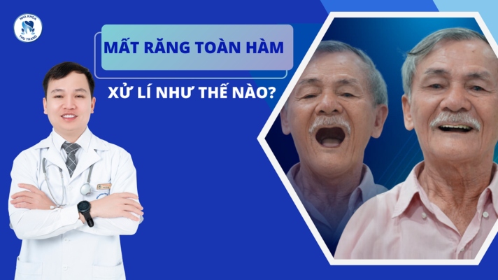 Mất răng toàn hàm phải xử lí như thế nào?