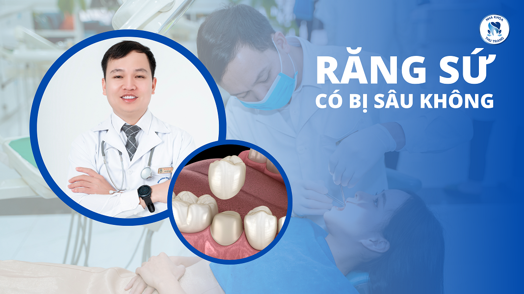 Bọc răng sứ có bị sâu không?